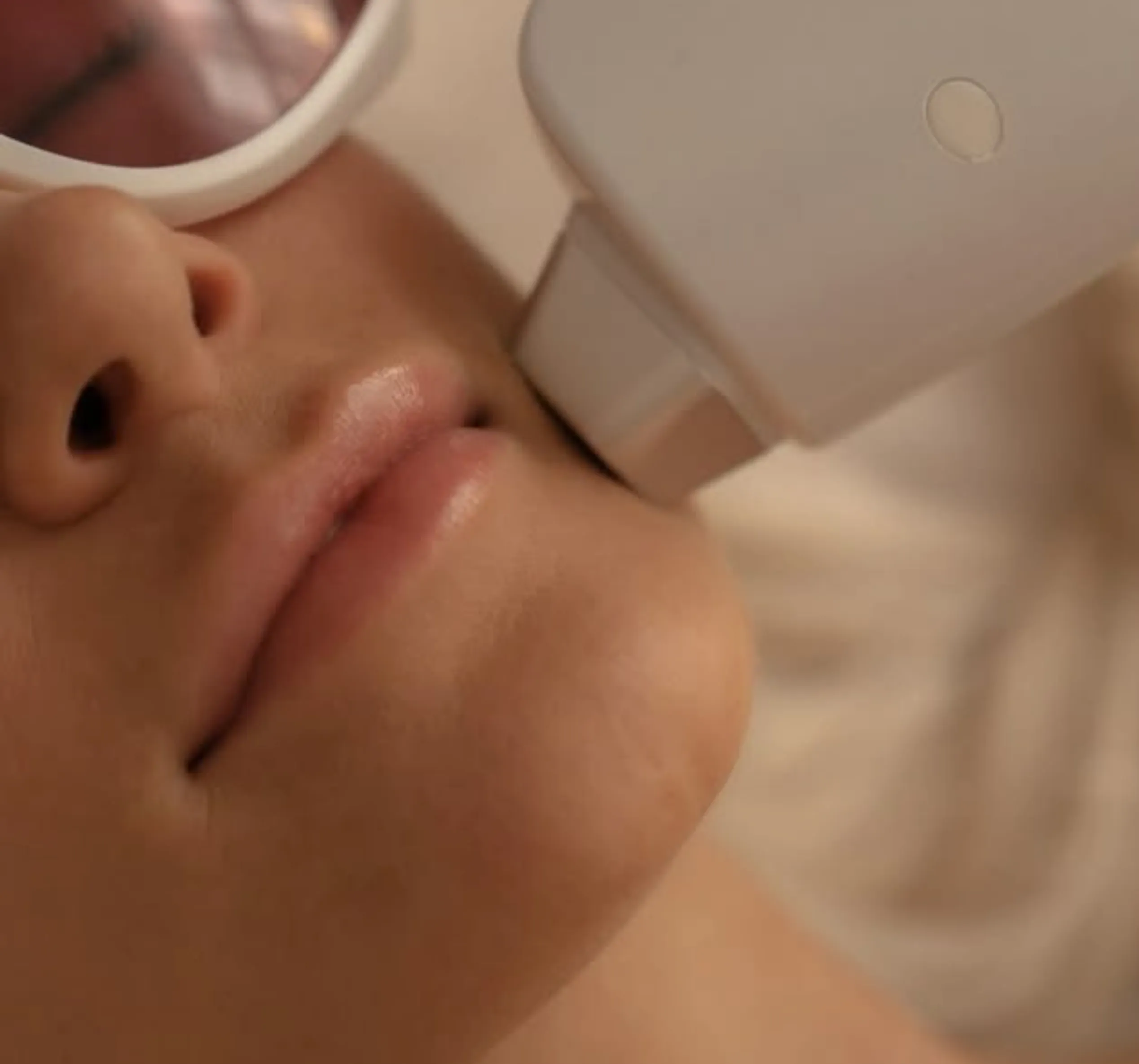 buy laser hair removal machine Australia