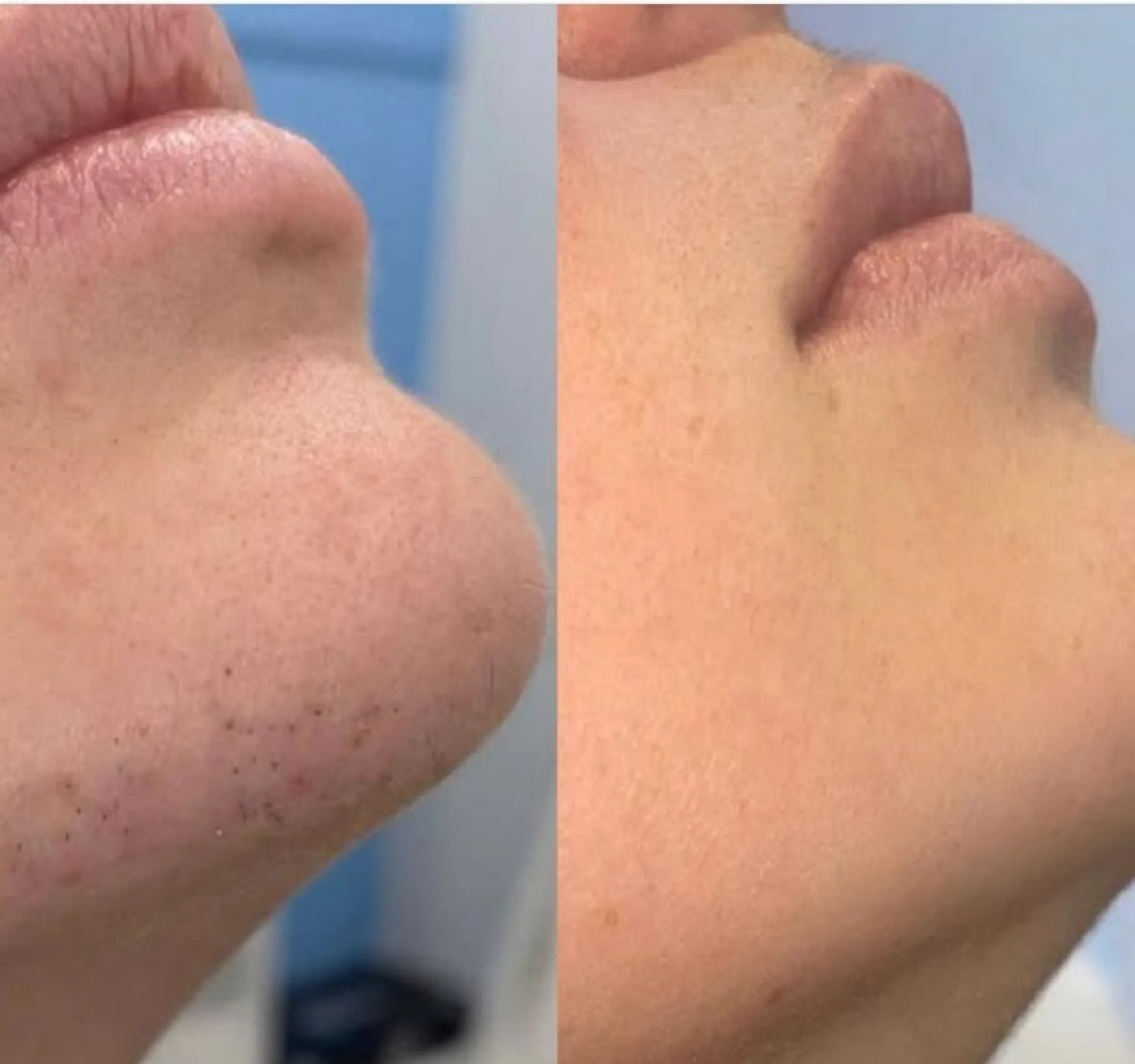 laser clinic startup cost