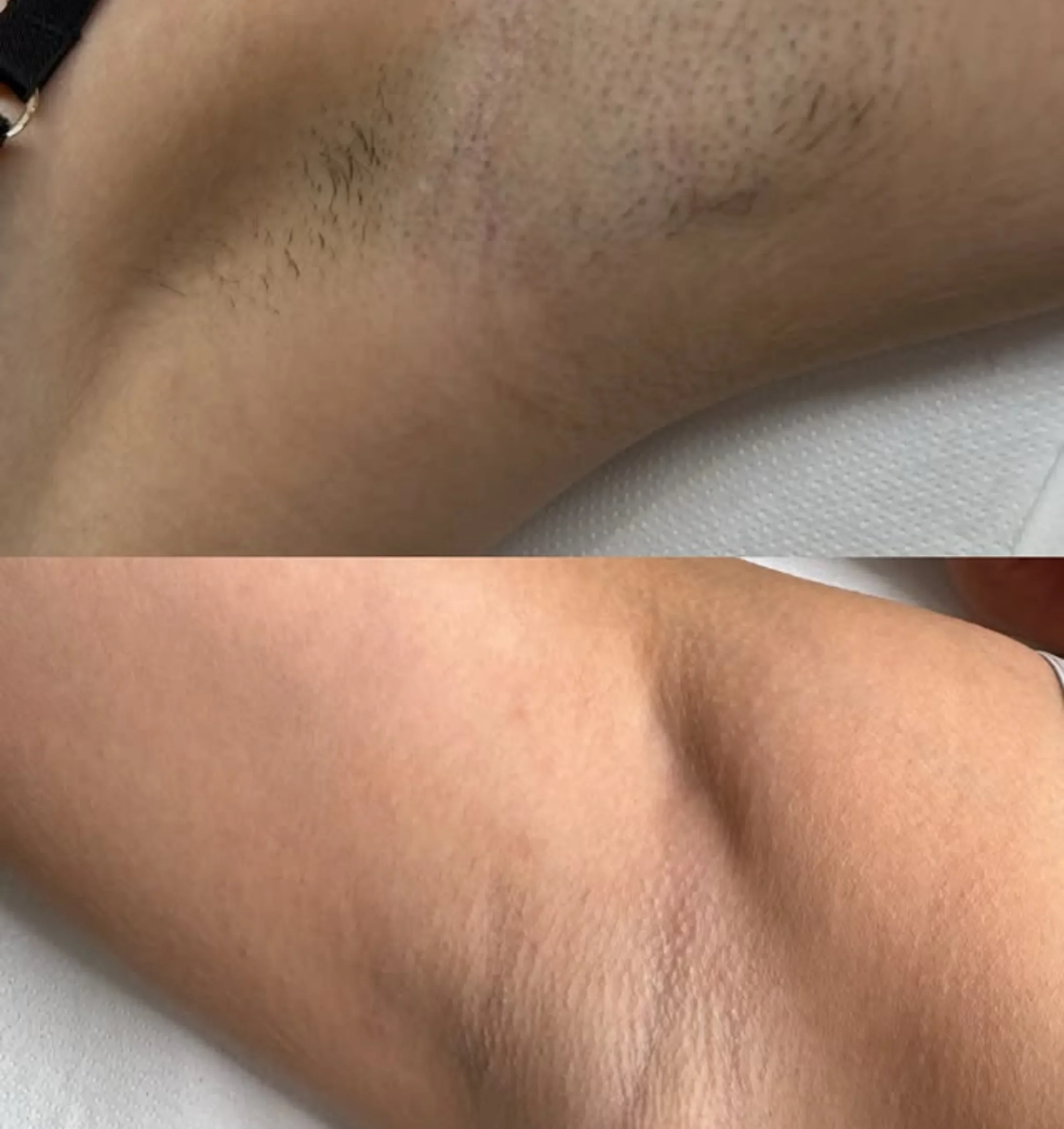 laser hair removal business requirements