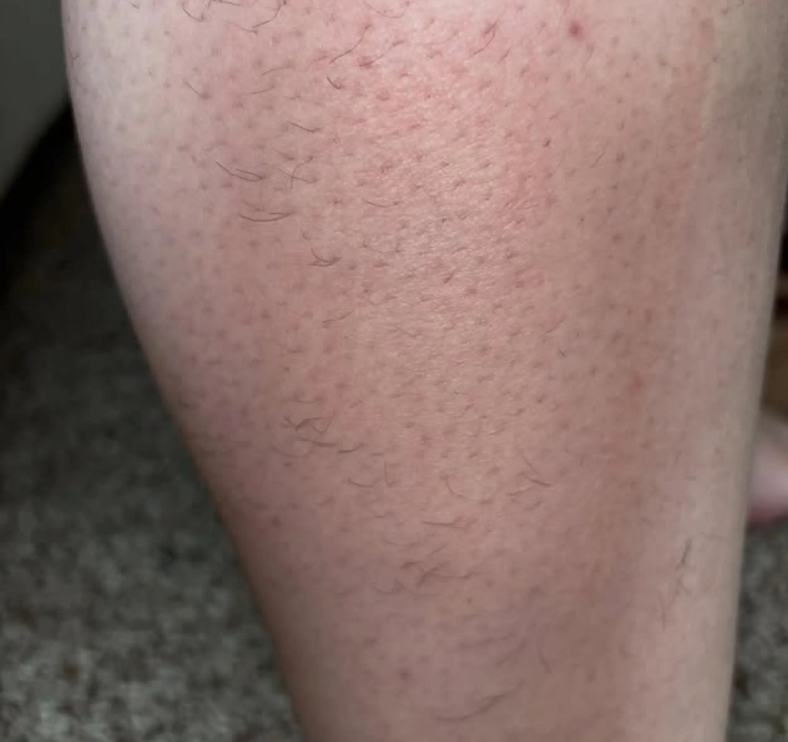 starting a beauty laser clinic